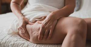 What Is Cellulite, and What Can You Do About It? What Is Cellulite, and What Can You Do About It?